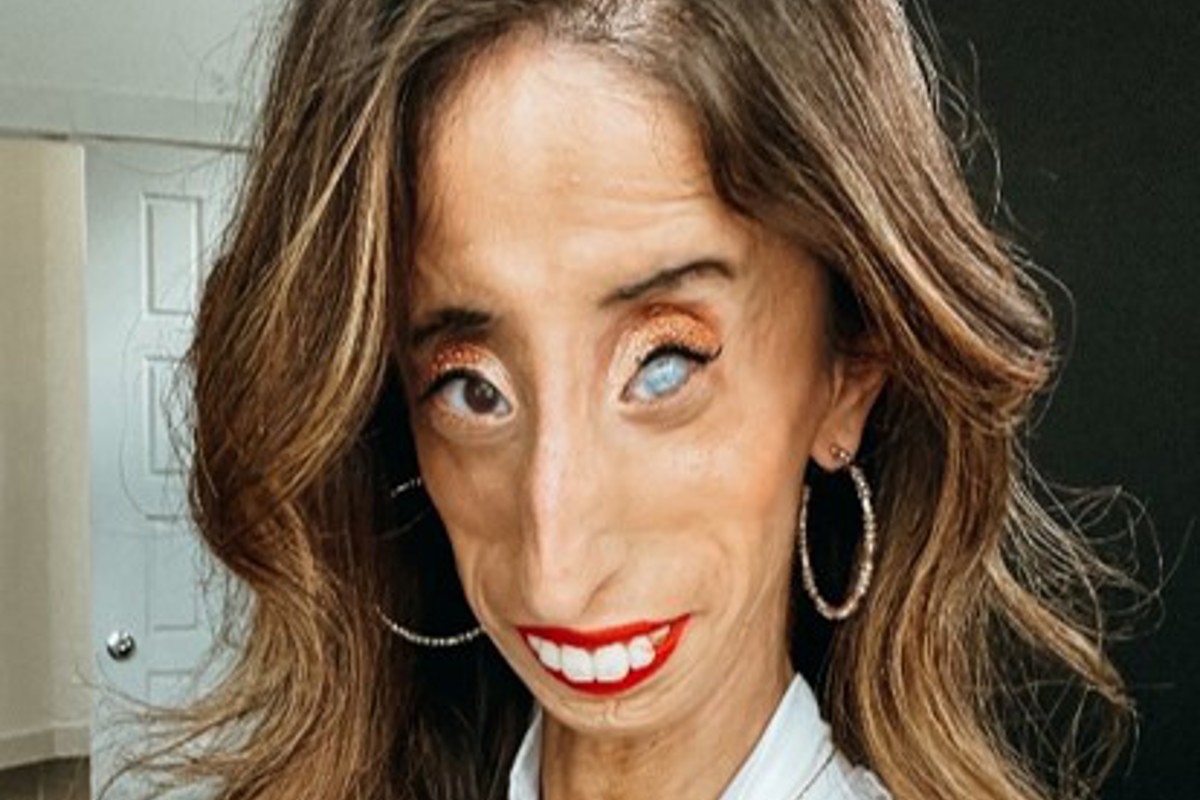 Lizzie Velasquez