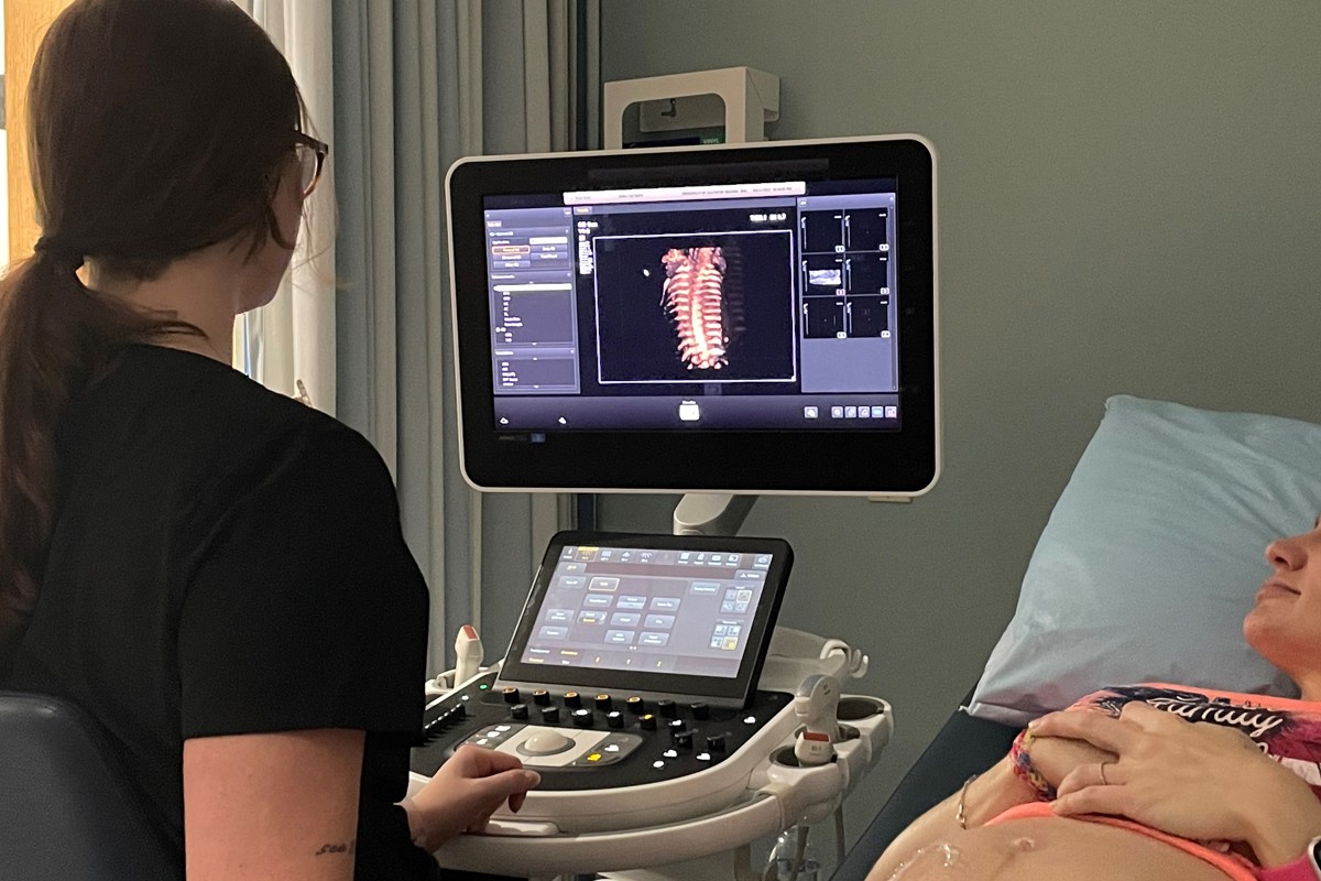 USI Sonography offering free pregnancy ultrasounds